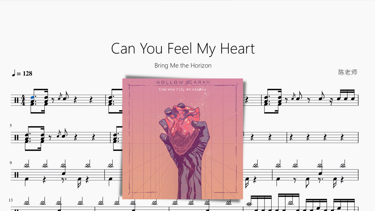 Can You Feel My Heart【Bring Me the Horizon】